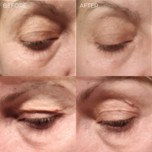 BEAUTICAL Eyelash Enhancing Serum before-after