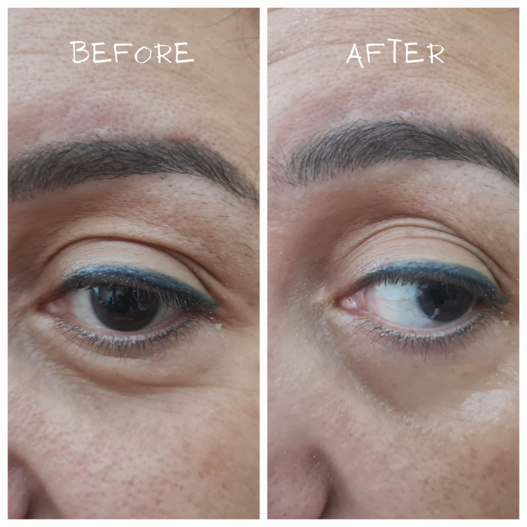BEAUTICAL Instant Lifting Serum before after