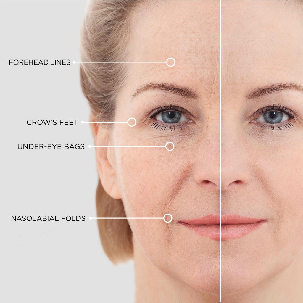 instant lifting serum beautical application wrinkles eyes front