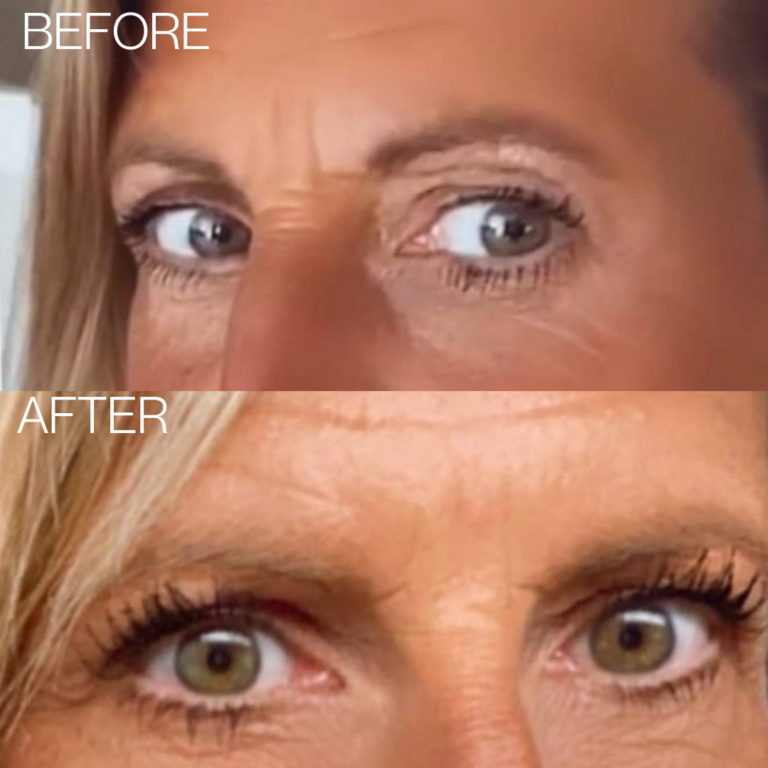 beautical eyelash enhancing growth serum before after